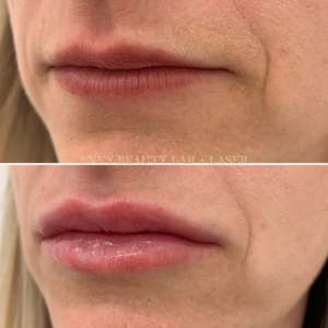 Lips (4)