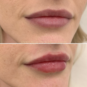 Lips (5)